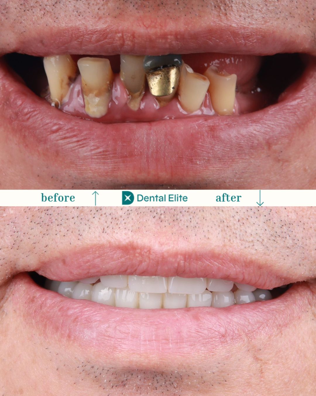 Dental Elite caz 9