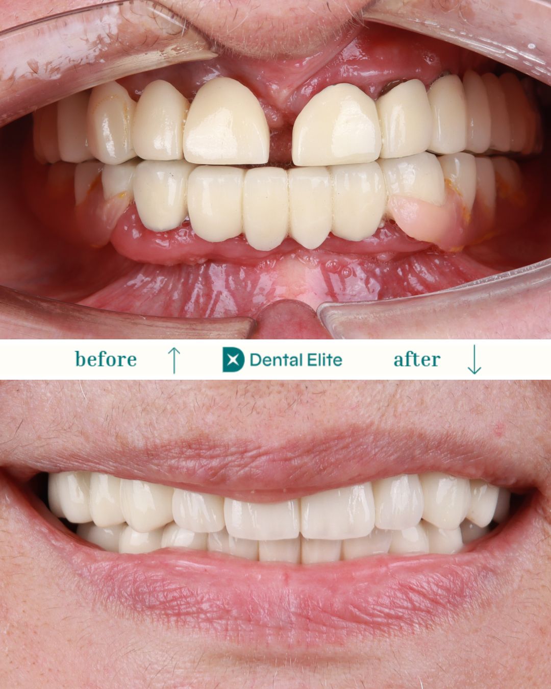 before after caz 6